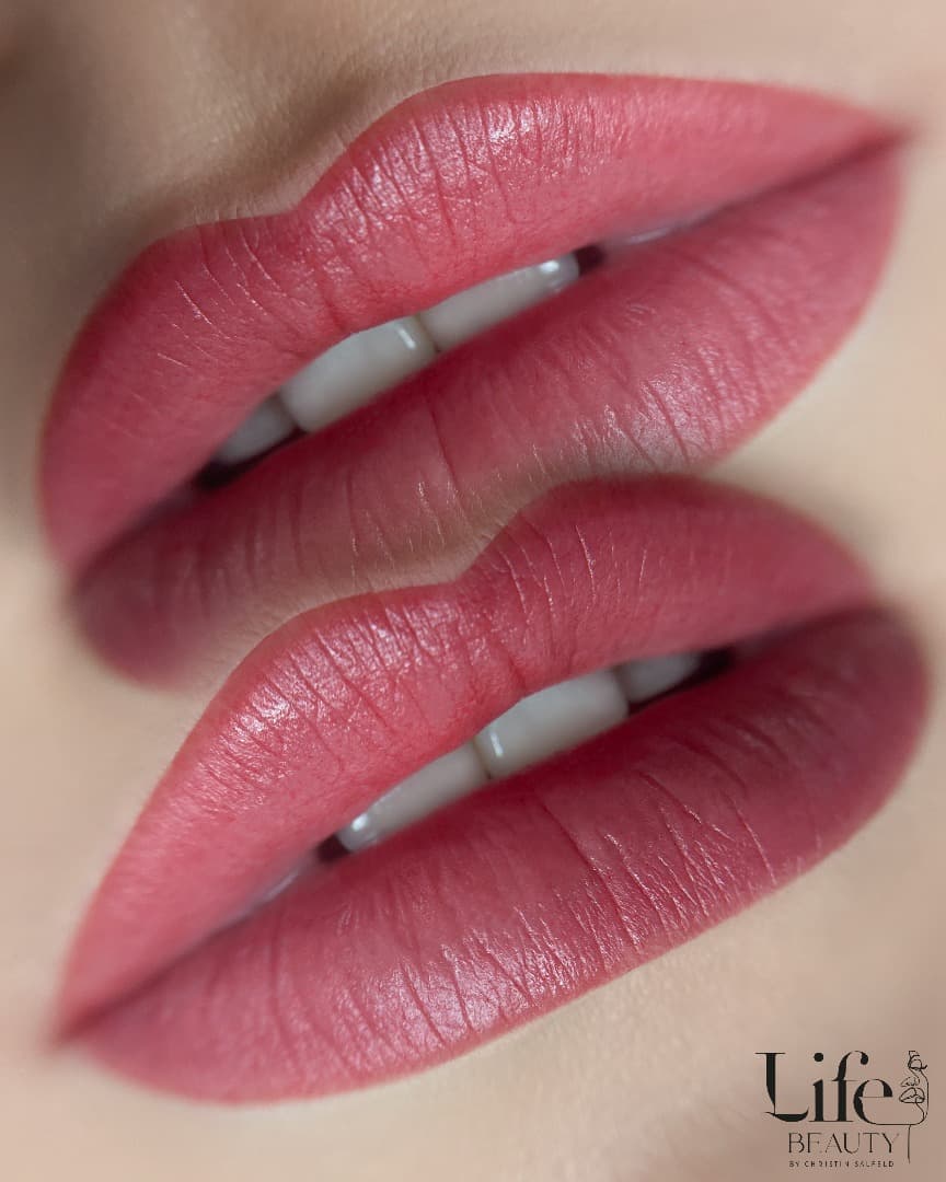 Velvet Lips Vorher Nachher